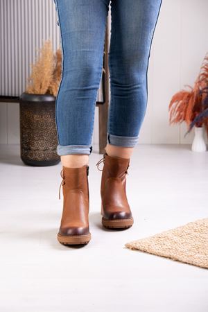 ALBİNİ HAKİKİ DERİ KADIN GÜNLÜK BOT 10110623K