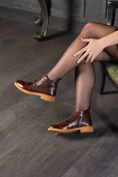 ALBİNİ HAKİKİ DERİ KADIN BOT 2610345725K