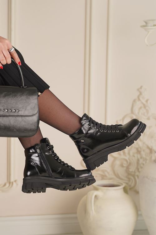 ALBİNİ HAKİKİ DERİ KADIN GÜNLÜK BOT 10295025K